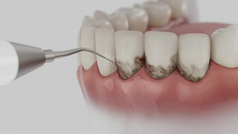 Reliable Emergency Dentist contractor in Riverview, FL by Smile Center Dentistry